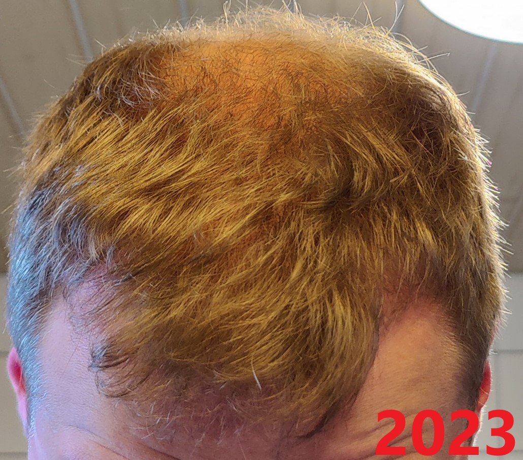 /foren/transplant/index.php/fa/61989/0/