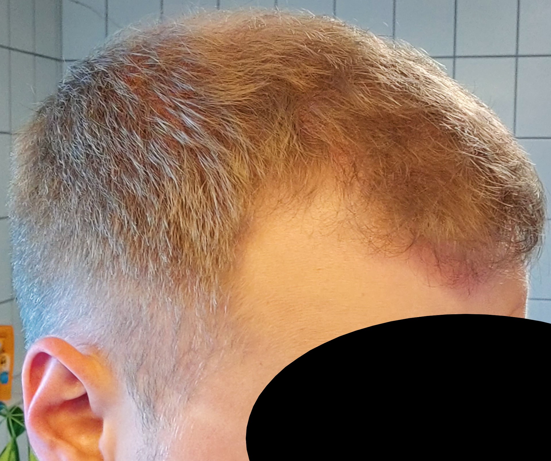 /foren/transplant/index.php/fa/61994/0/