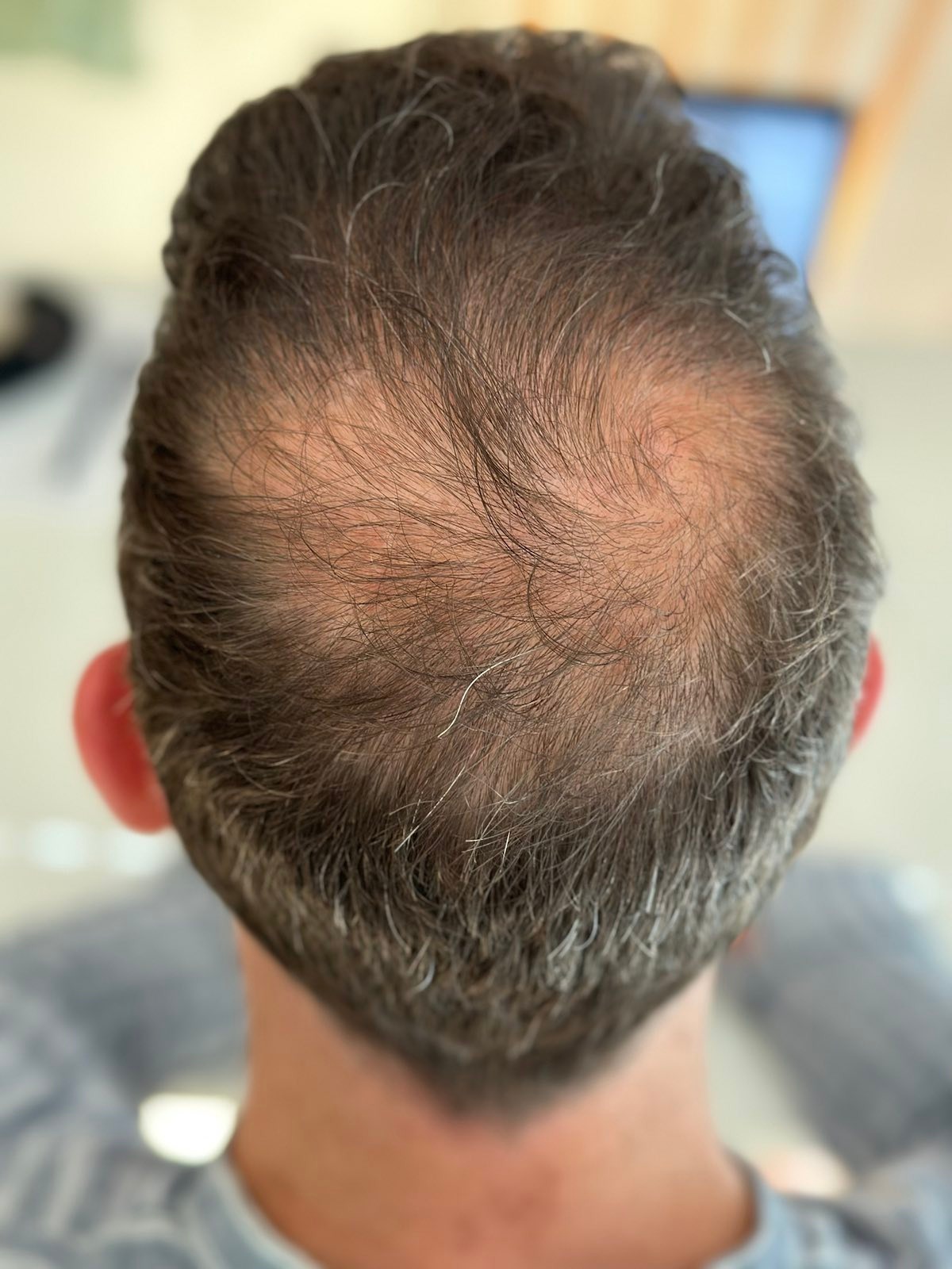 /foren/transplant/index.php/fa/62044/0/