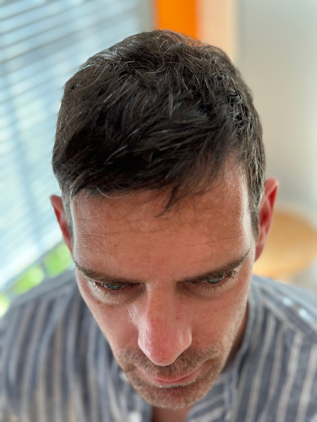 /foren/transplant/index.php/fa/62045/0/