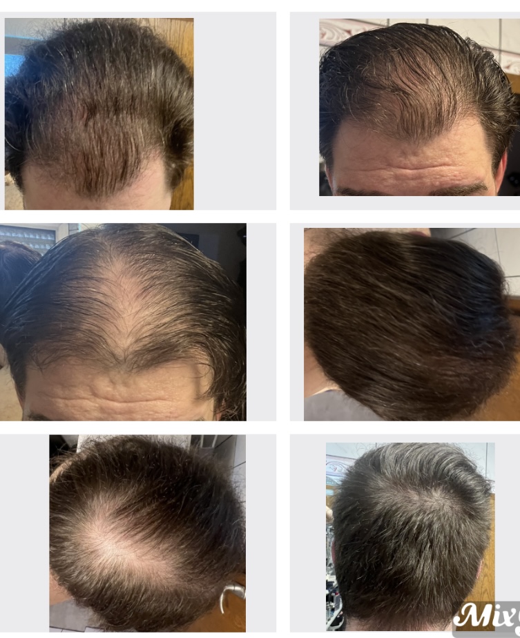 /foren/transplant/index.php/fa/62102/0/