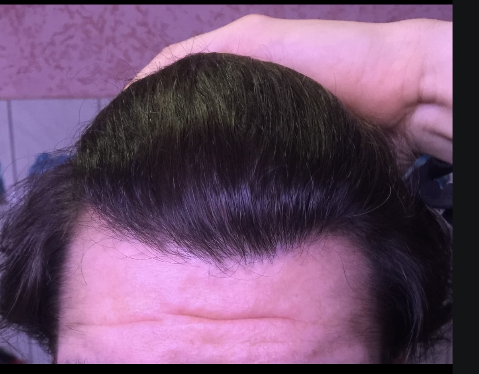 /foren/transplant/index.php/fa/62103/0/