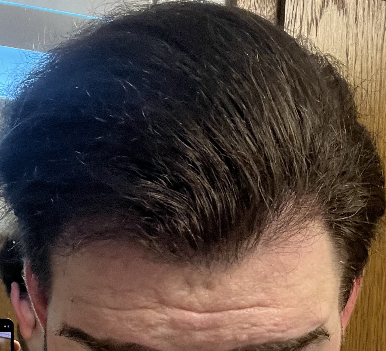 /foren/transplant/index.php/fa/62108/0/