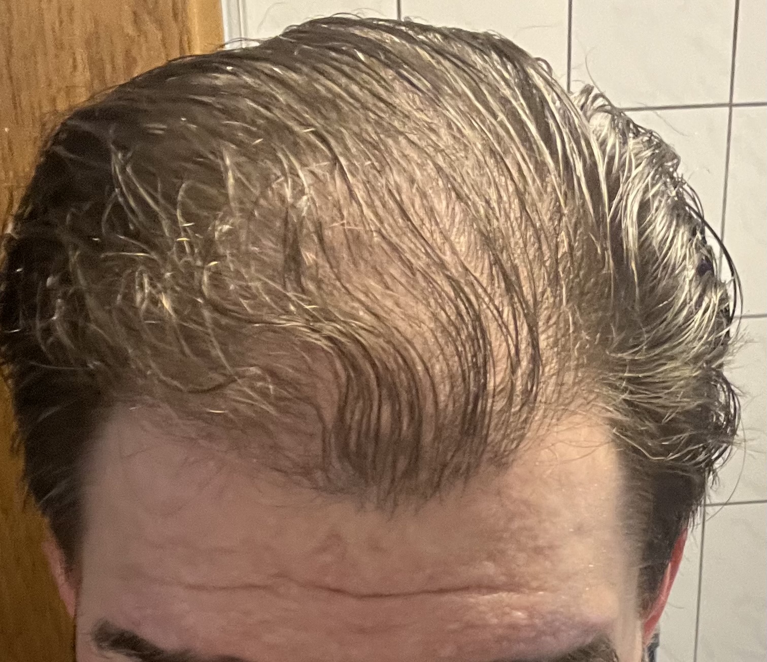 /foren/transplant/index.php/fa/62111/0/