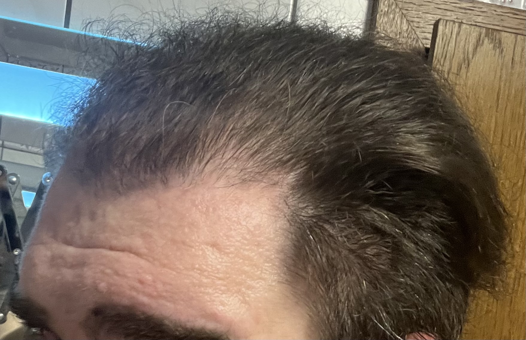 /foren/transplant/index.php/fa/62112/0/