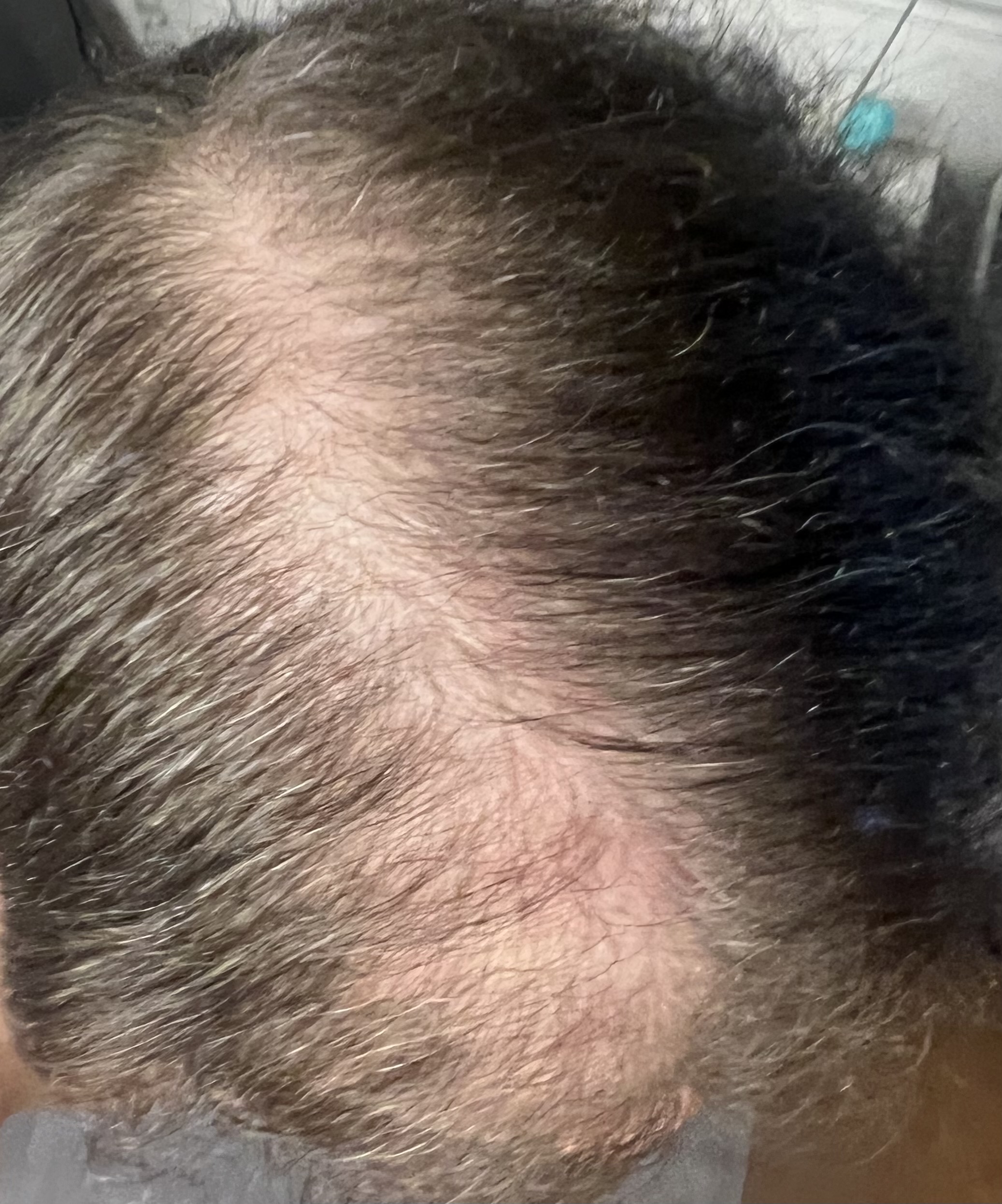 /foren/transplant/index.php/fa/62114/0/