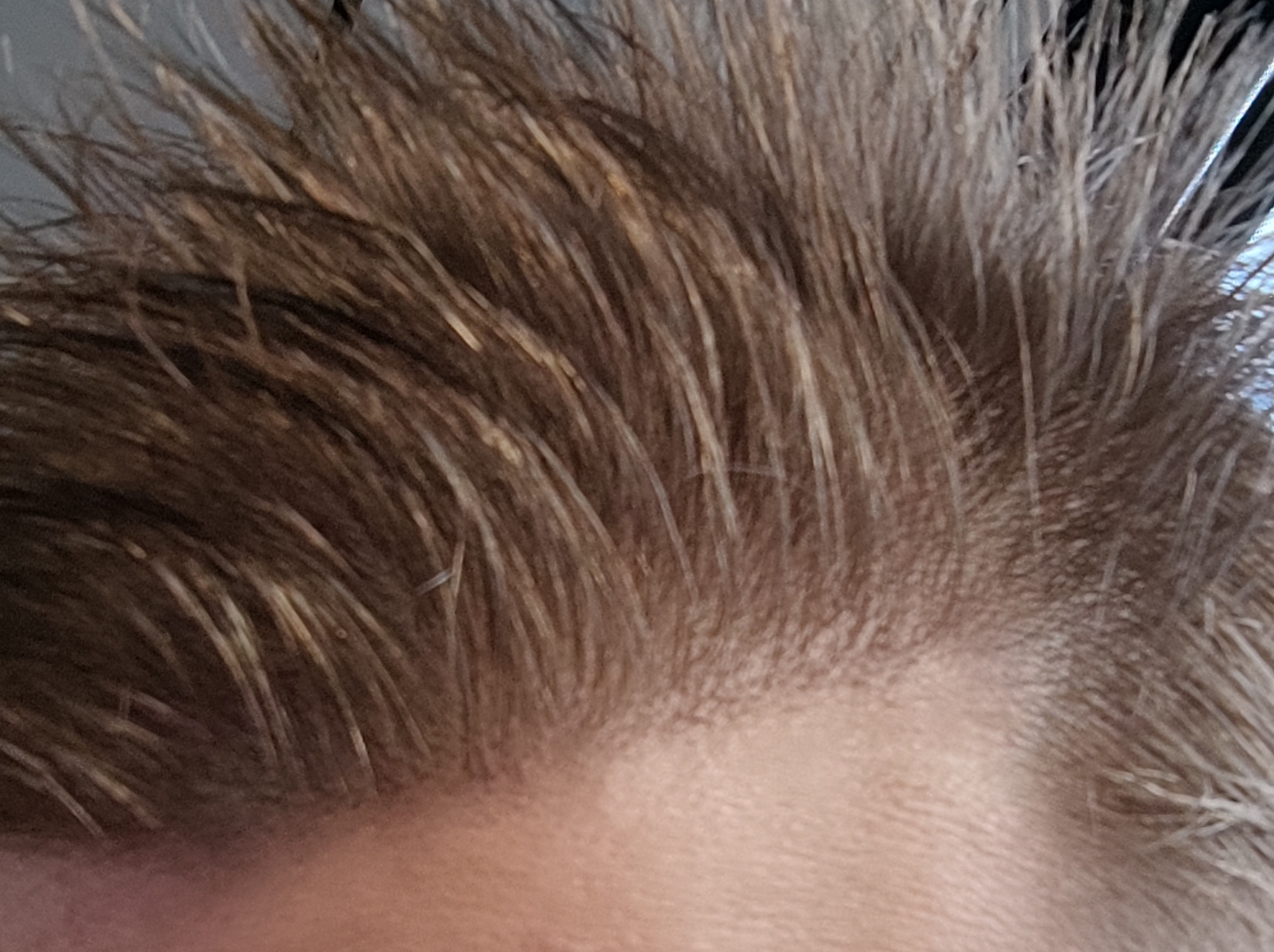 /foren/transplant/index.php/fa/62161/0/