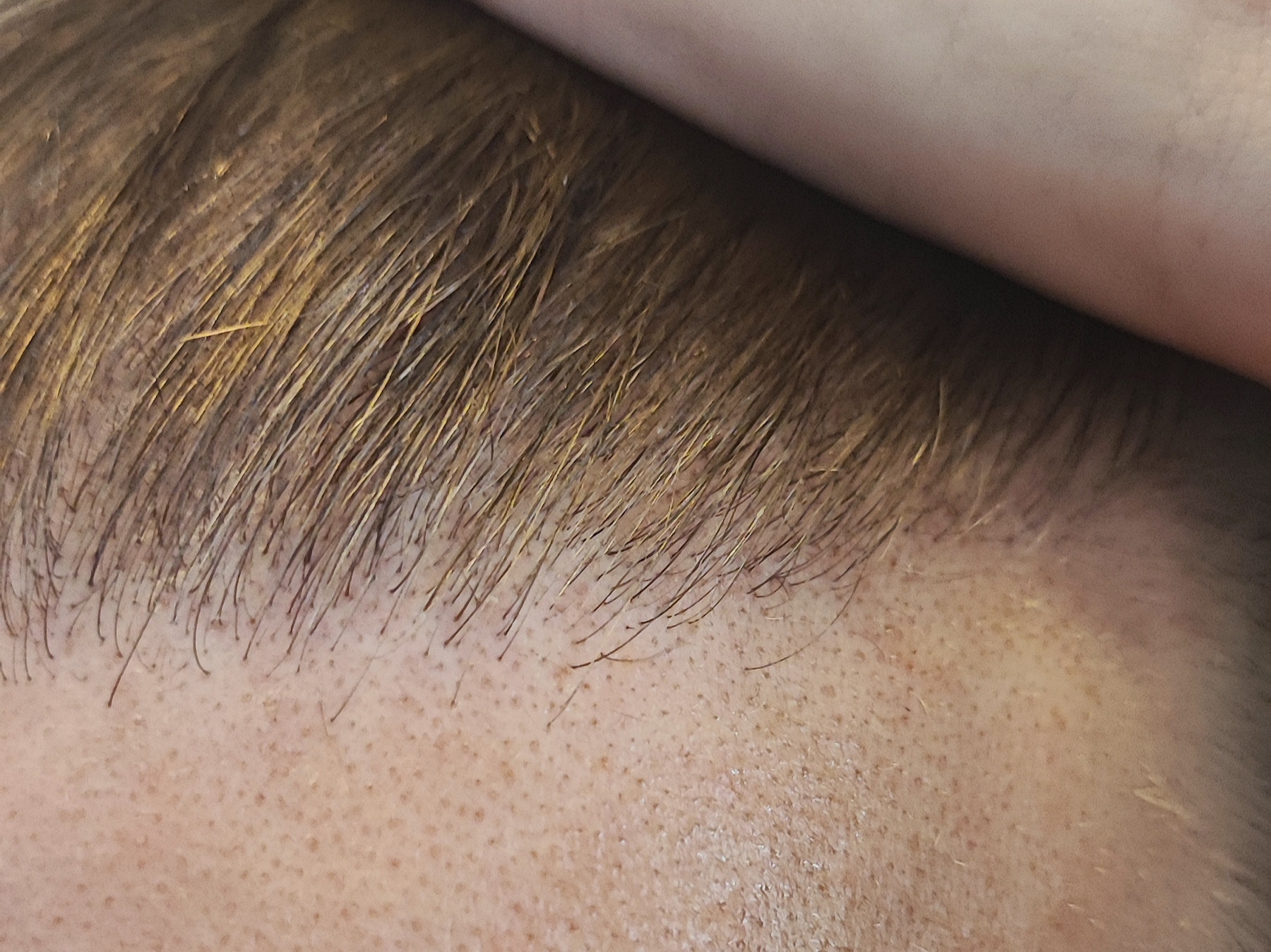 /foren/transplant/index.php/fa/62163/0/