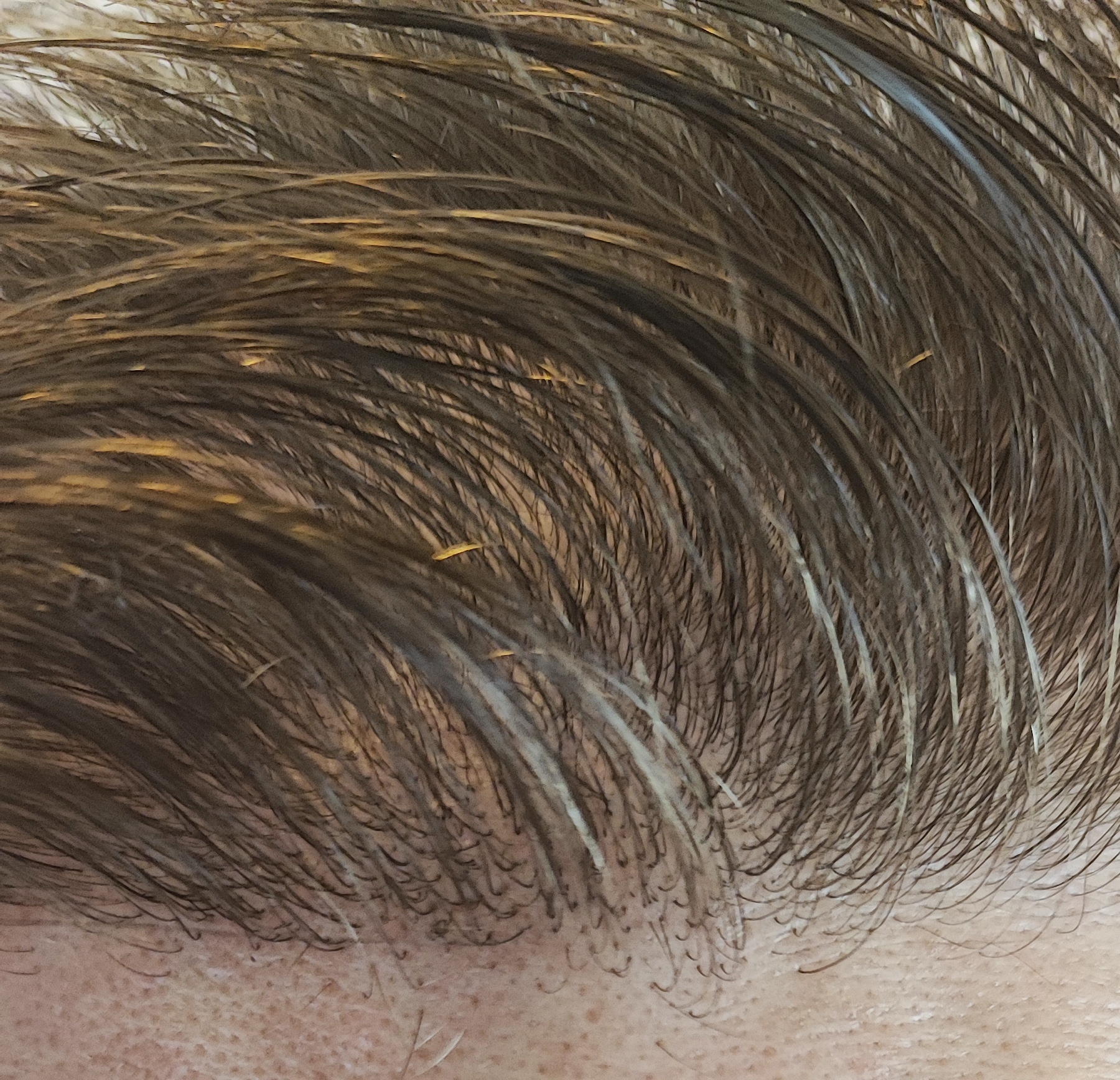 /foren/transplant/index.php/fa/62165/0/