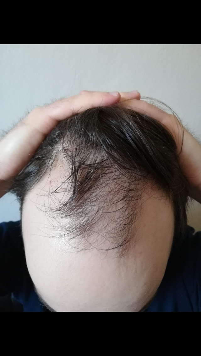 /foren/transplant/index.php/fa/62177/0/