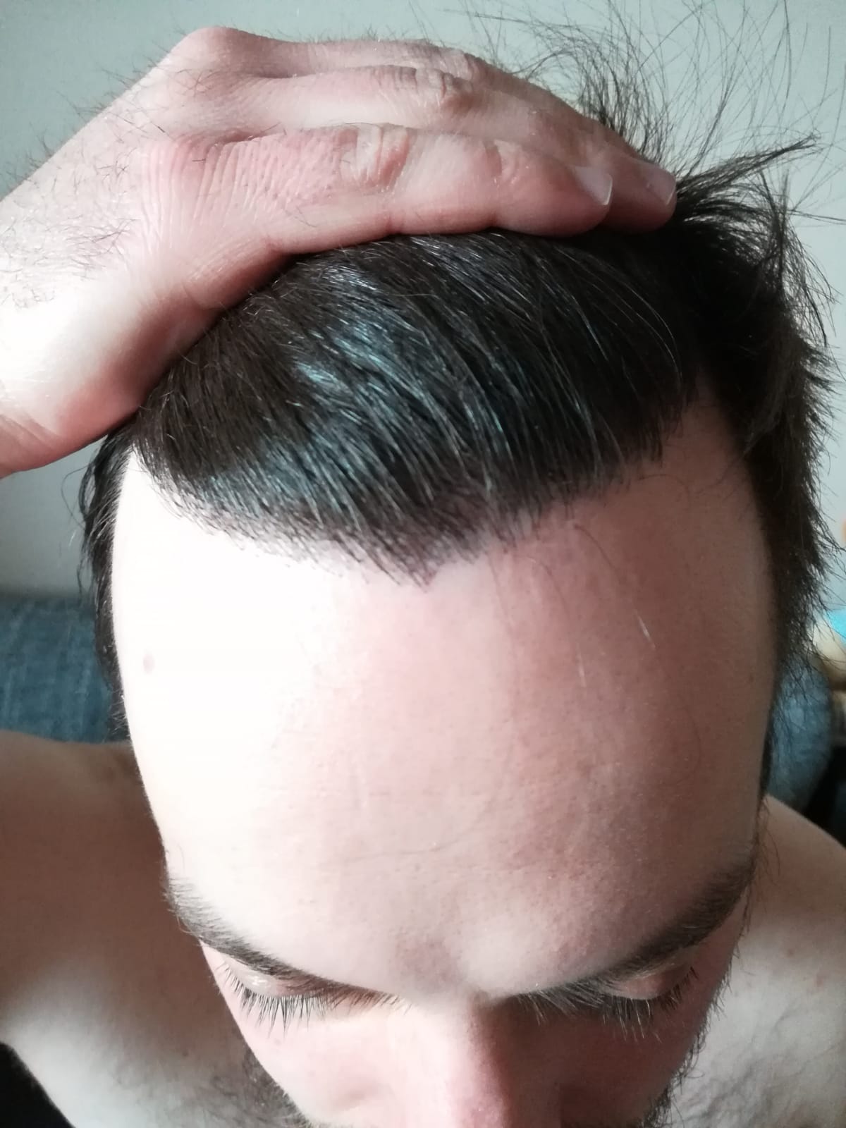 /foren/transplant/index.php/fa/62181/0/