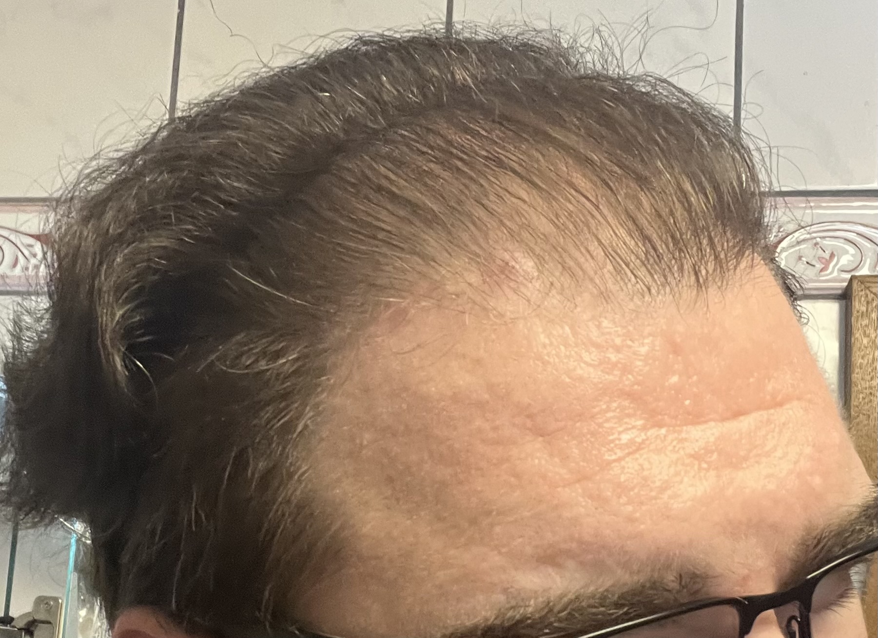 /foren/transplant/index.php/fa/62198/0/