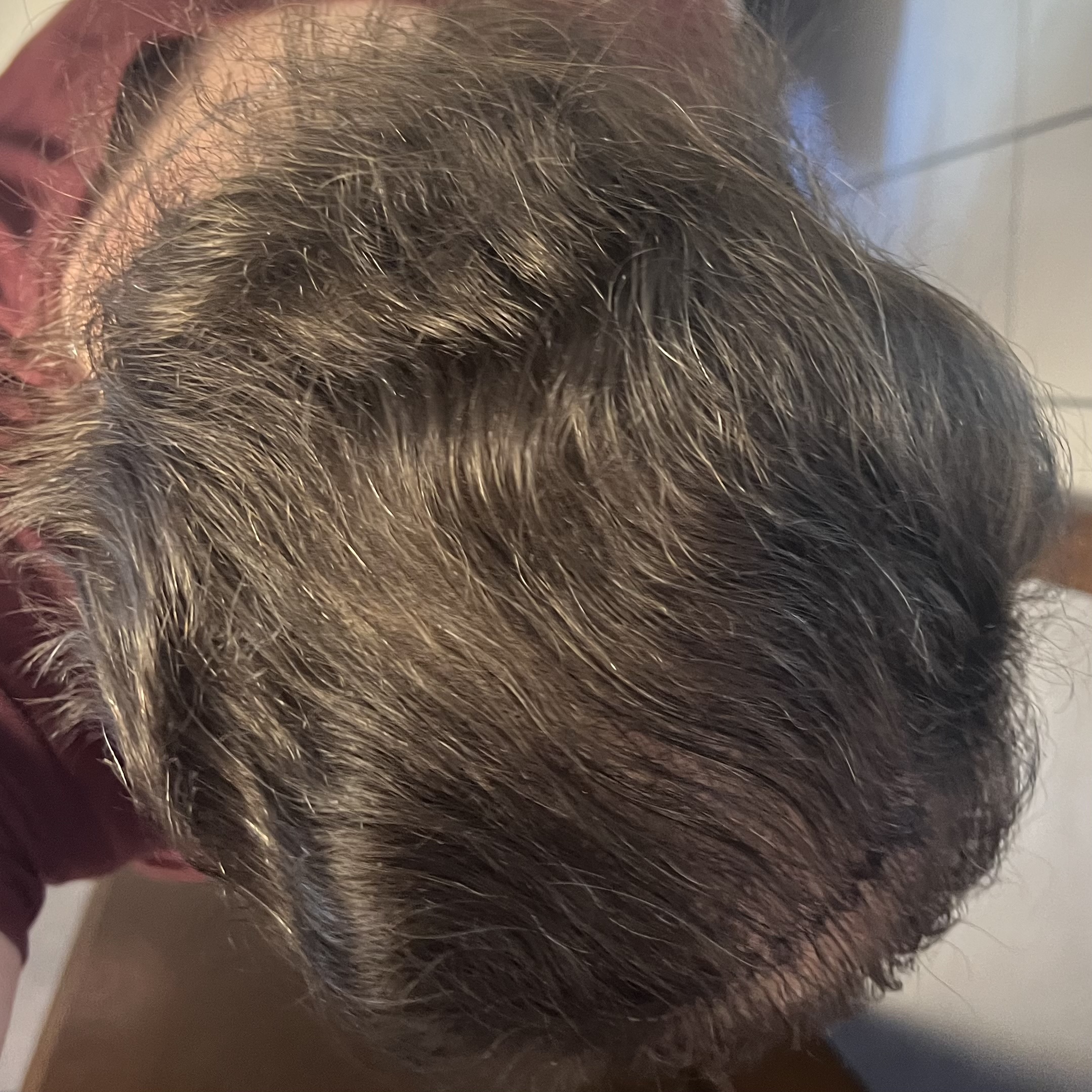 /foren/transplant/index.php/fa/62199/0/