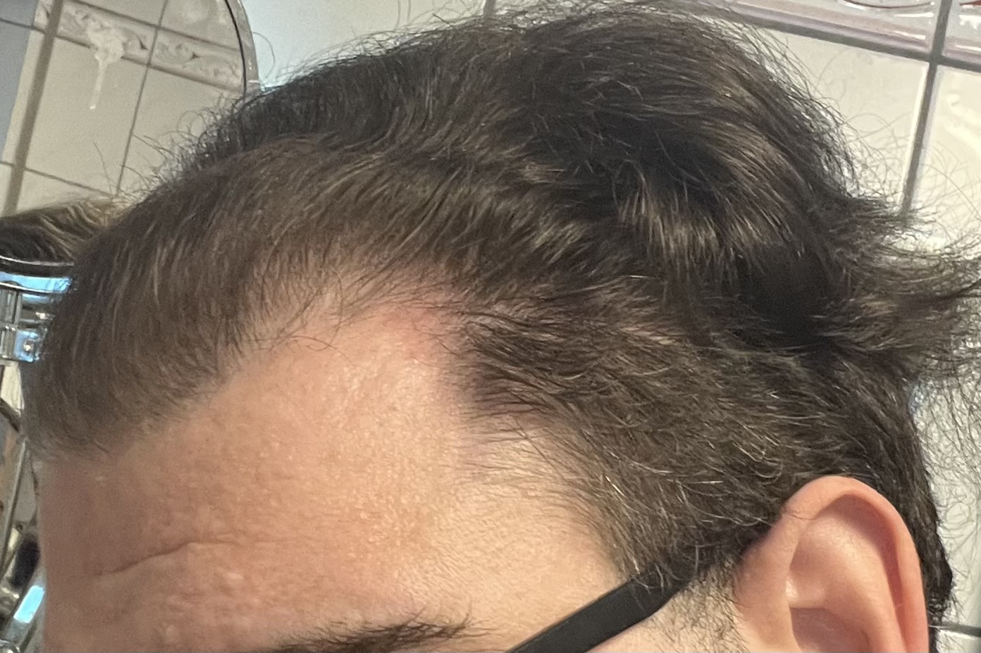 /foren/transplant/index.php/fa/62202/0/