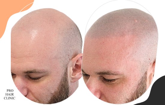 /foren/transplant/index.php/fa/62231/0/