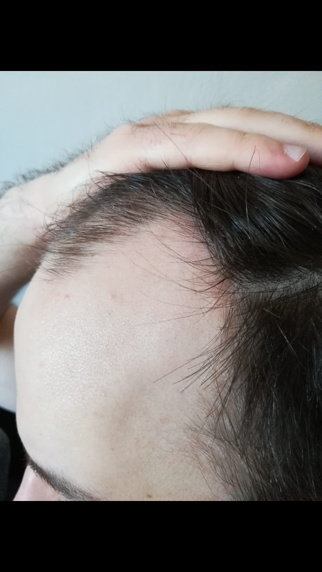 /foren/transplant/index.php/fa/62246/0/