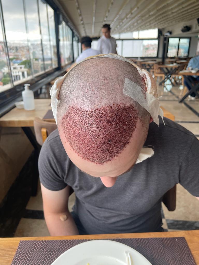 /foren/transplant/index.php/fa/62248/0/