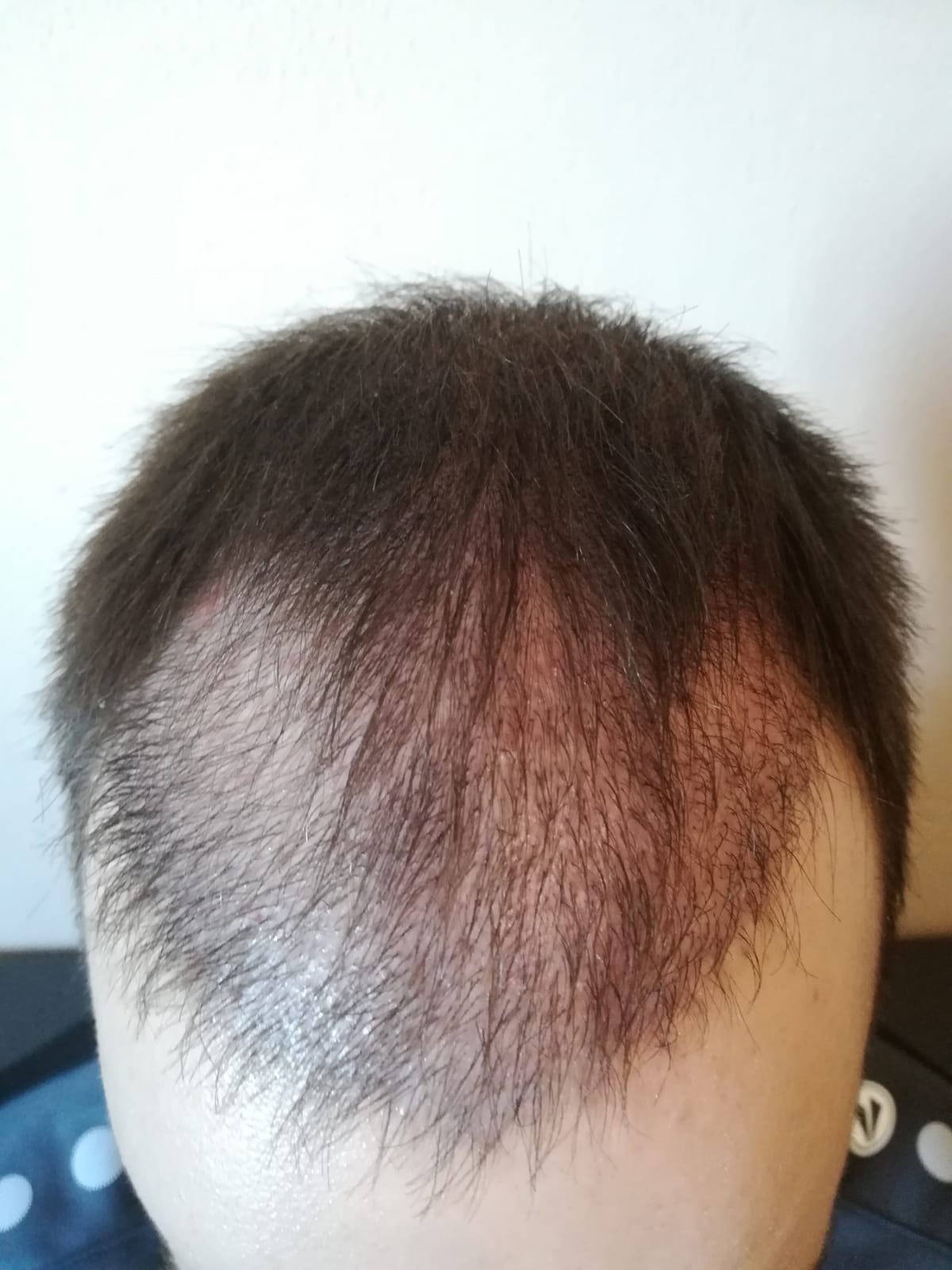 /foren/transplant/index.php/fa/62250/0/