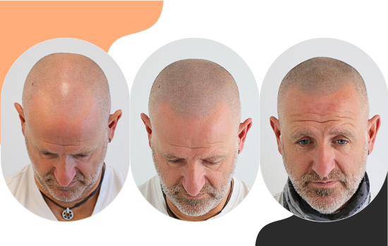 /foren/transplant/index.php/fa/62310/0/