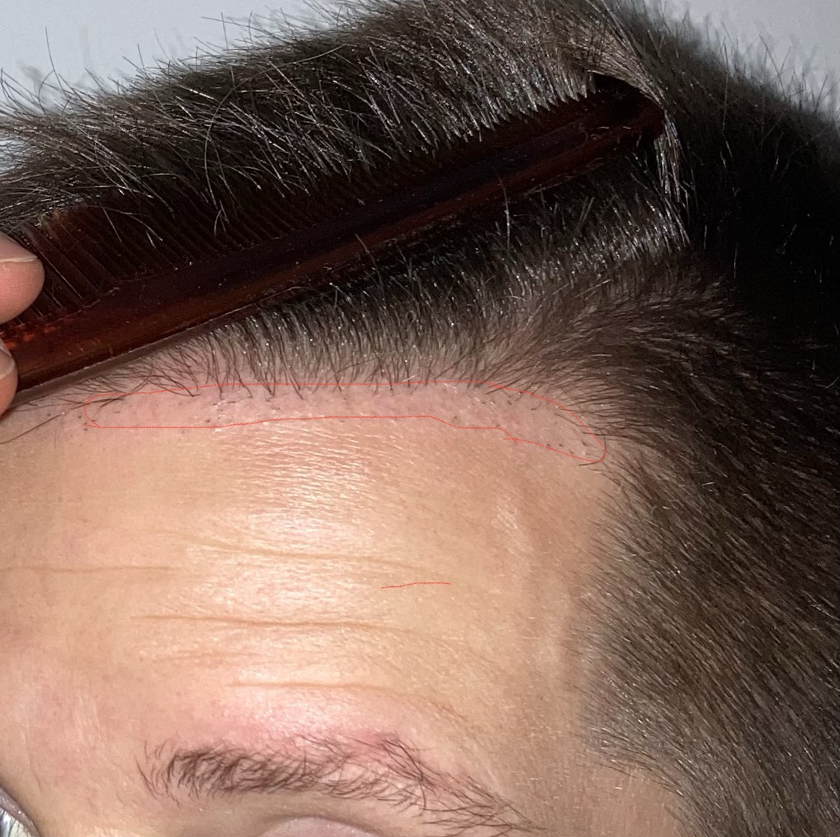 /foren/transplant/index.php/fa/62315/0/