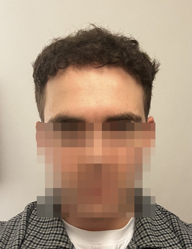 /foren/transplant/index.php/fa/62334/0/