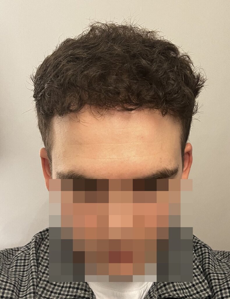 /foren/transplant/index.php/fa/62335/0/