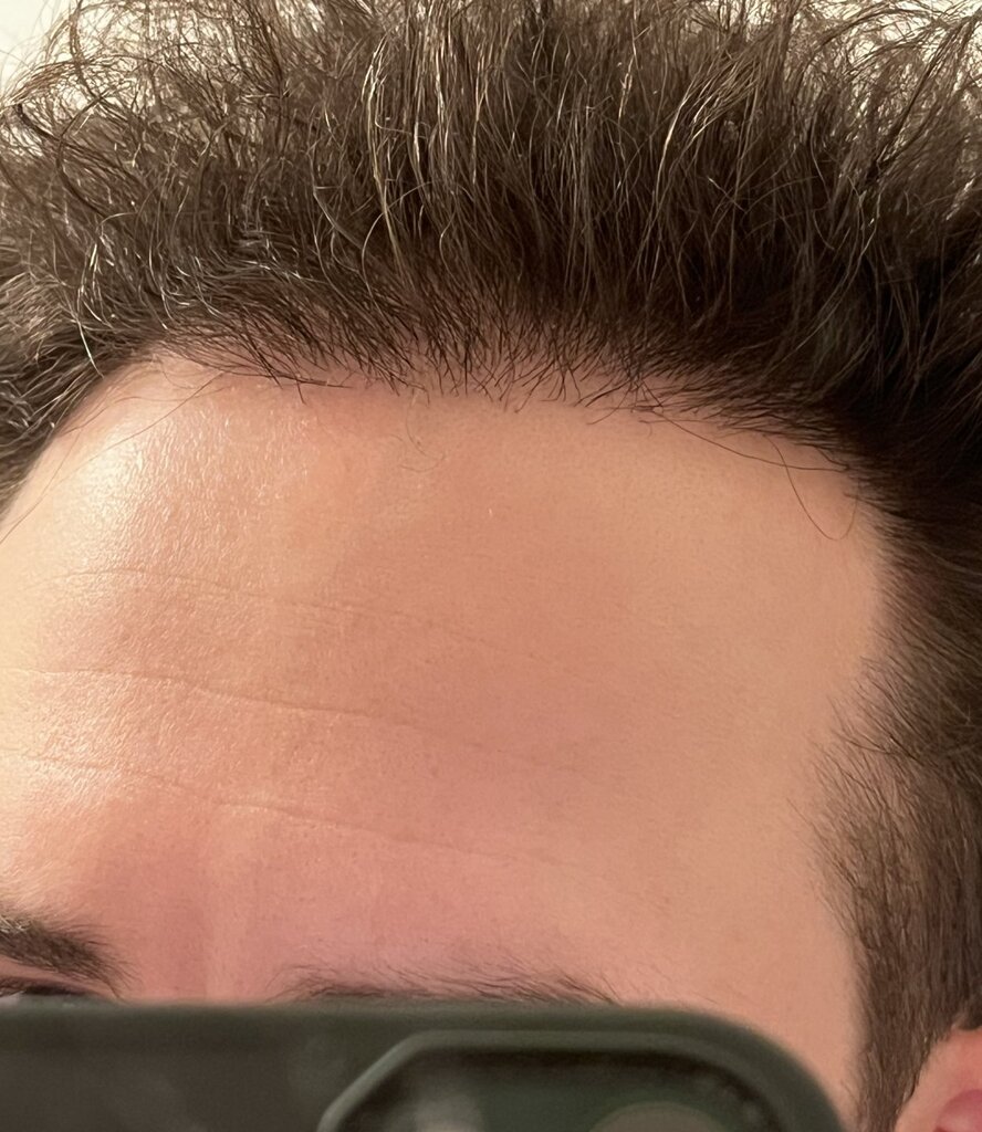 /foren/transplant/index.php/fa/62438/0/