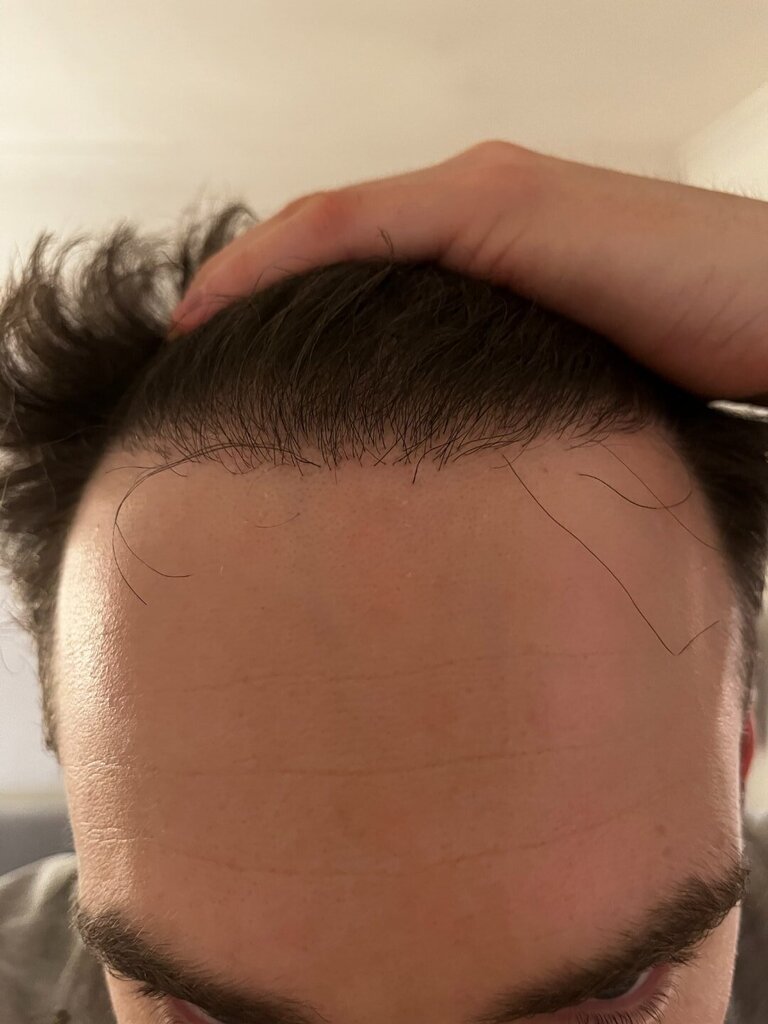 /foren/transplant/index.php/fa/62439/0/