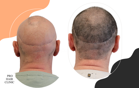 /foren/transplant/index.php/fa/62454/0/