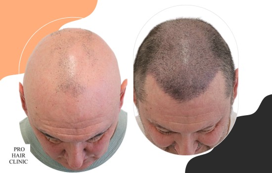 /foren/transplant/index.php/fa/62455/0/