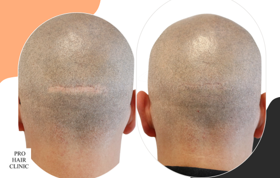 /foren/transplant/index.php/fa/62476/0/