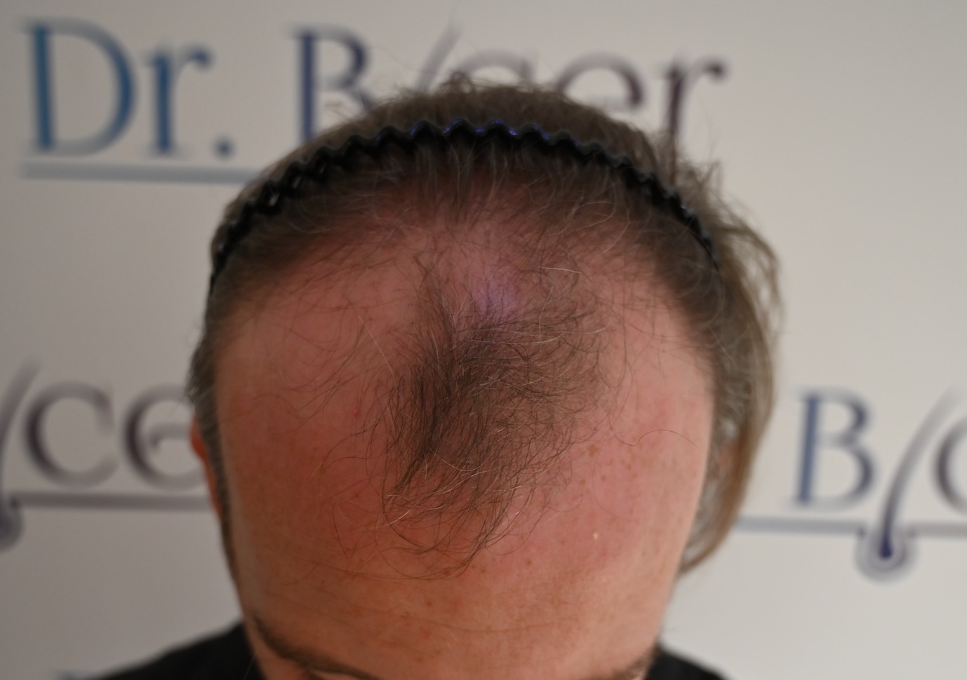 /foren/transplant/index.php/fa/62589/0/