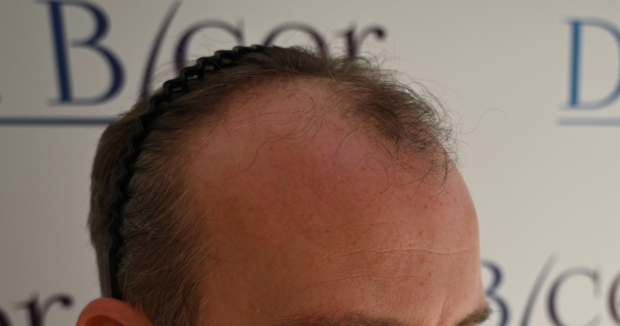 /foren/transplant/index.php/fa/62590/0/