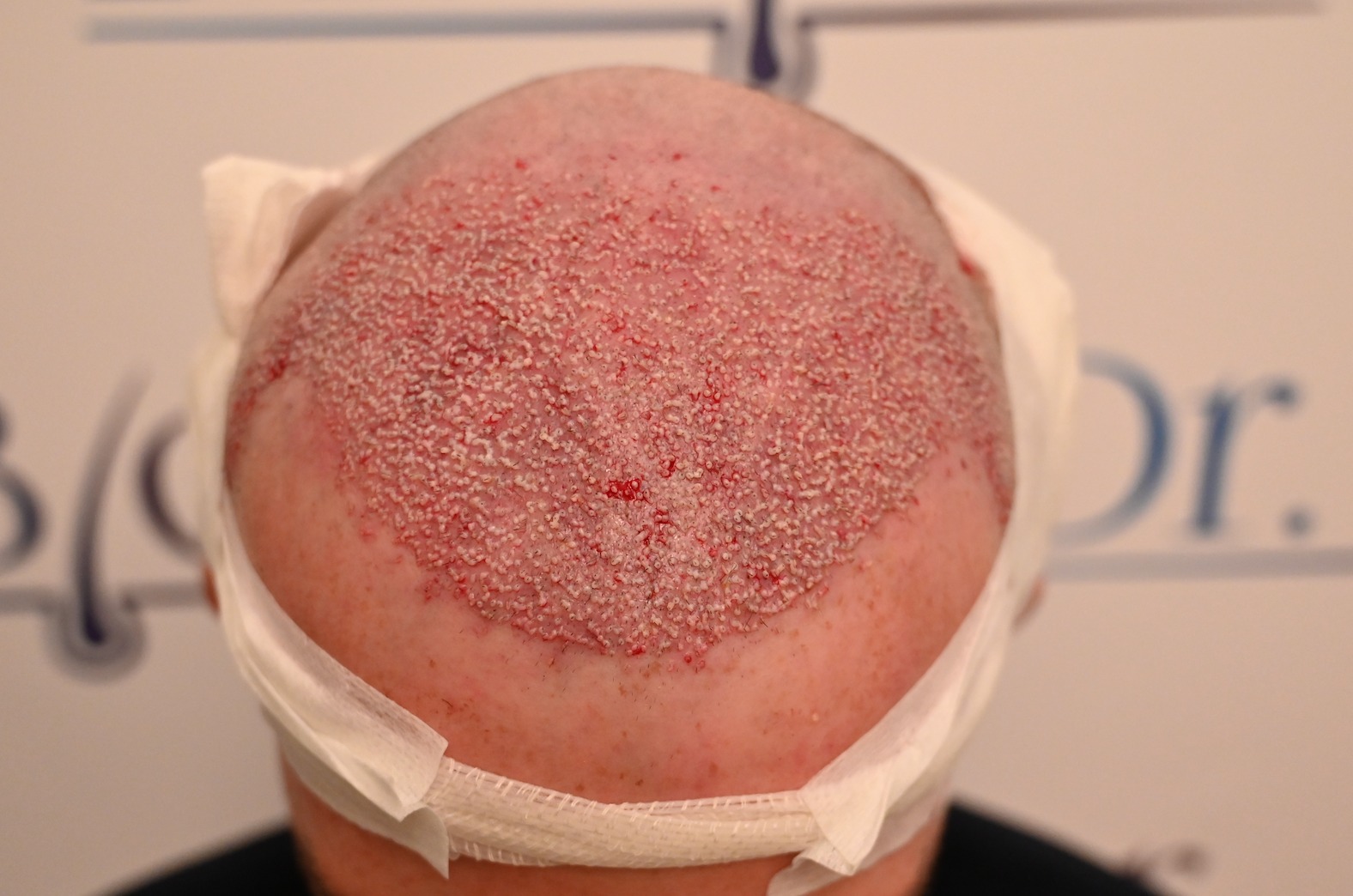 /foren/transplant/index.php/fa/62591/0/