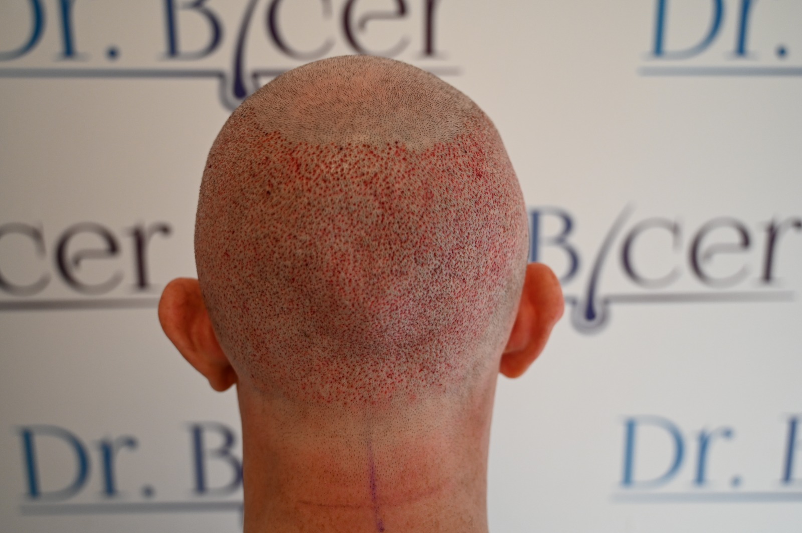 /foren/transplant/index.php/fa/62592/0/