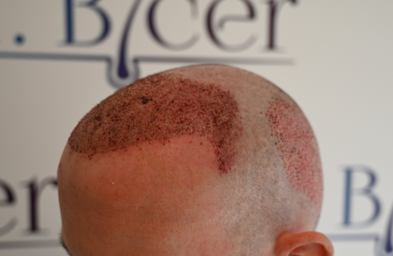 /foren/transplant/index.php/fa/62593/0/