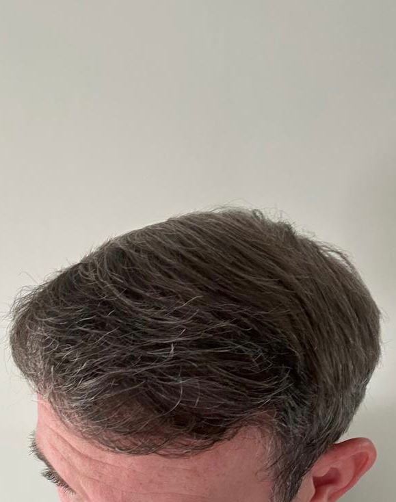 /foren/transplant/index.php/fa/62597/0/