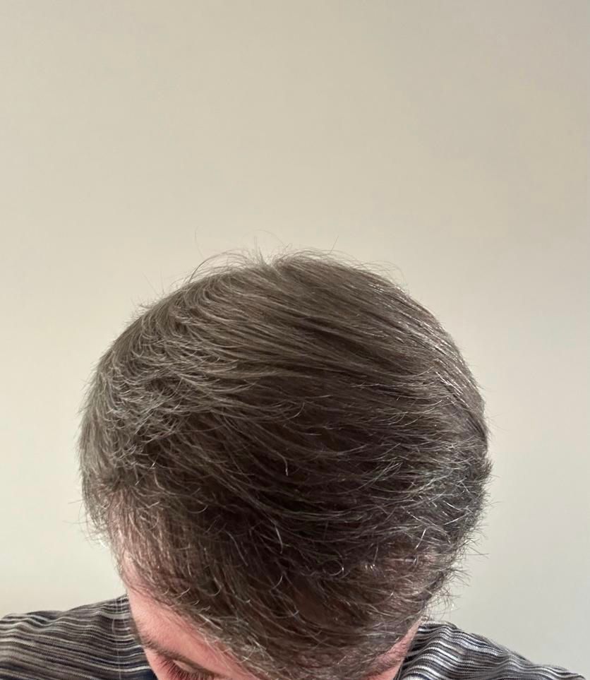 /foren/transplant/index.php/fa/62598/0/