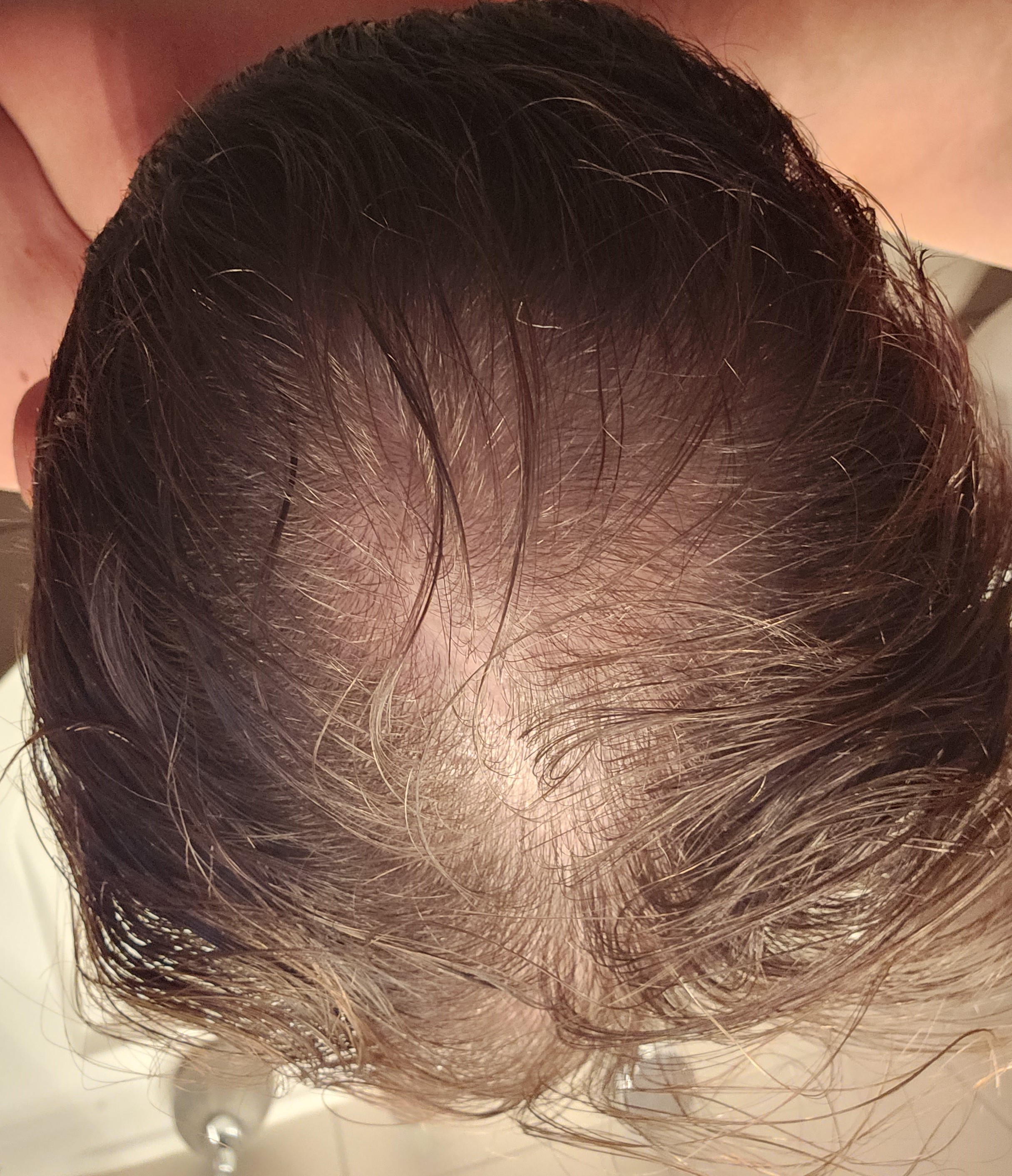 /foren/transplant/index.php/fa/62727/0/