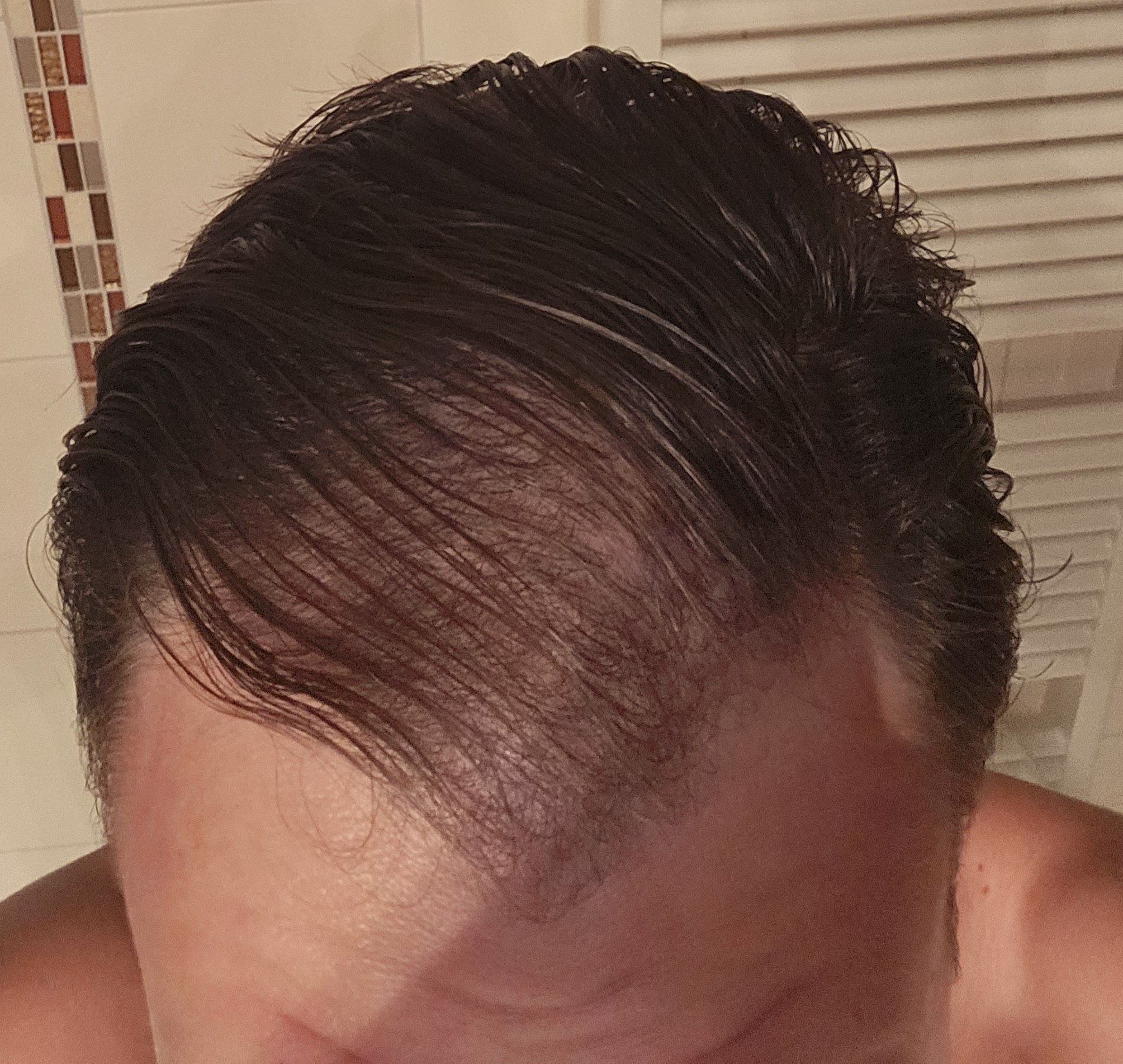 /foren/transplant/index.php/fa/62729/0/