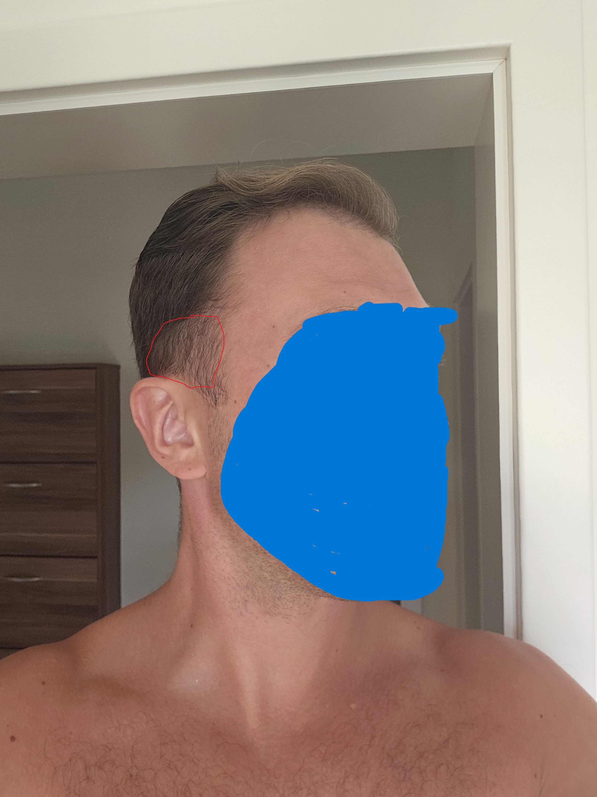 /foren/transplant/index.php/fa/62760/0/