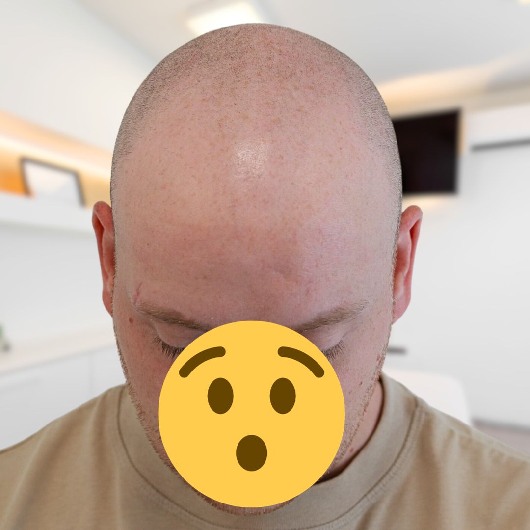 /foren/transplant/index.php/fa/62763/0/