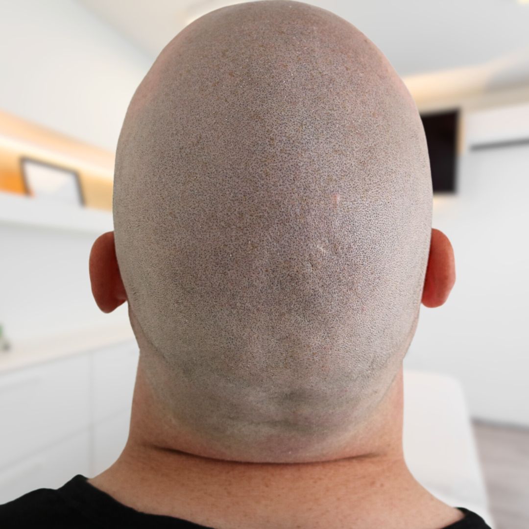 /foren/transplant/index.php/fa/62765/0/