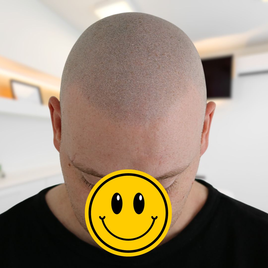 /foren/transplant/index.php/fa/62766/0/