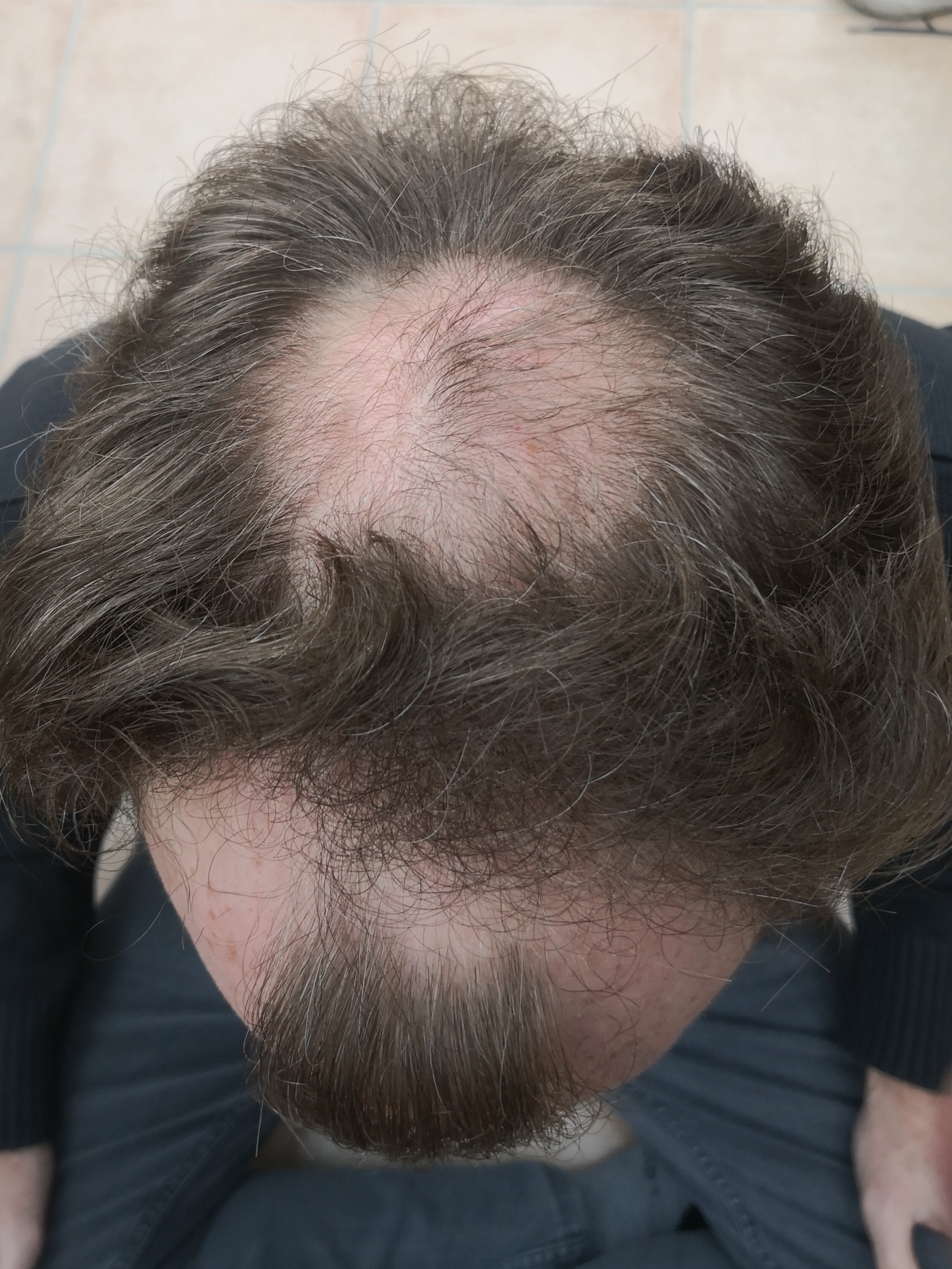 /foren/transplant/index.php/fa/62820/0/