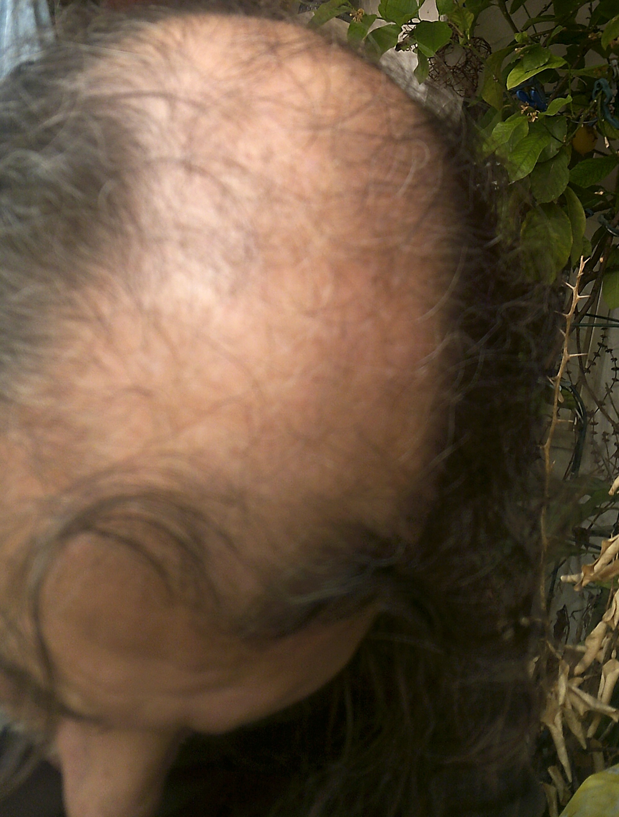 /foren/transplant/index.php/fa/62848/0/