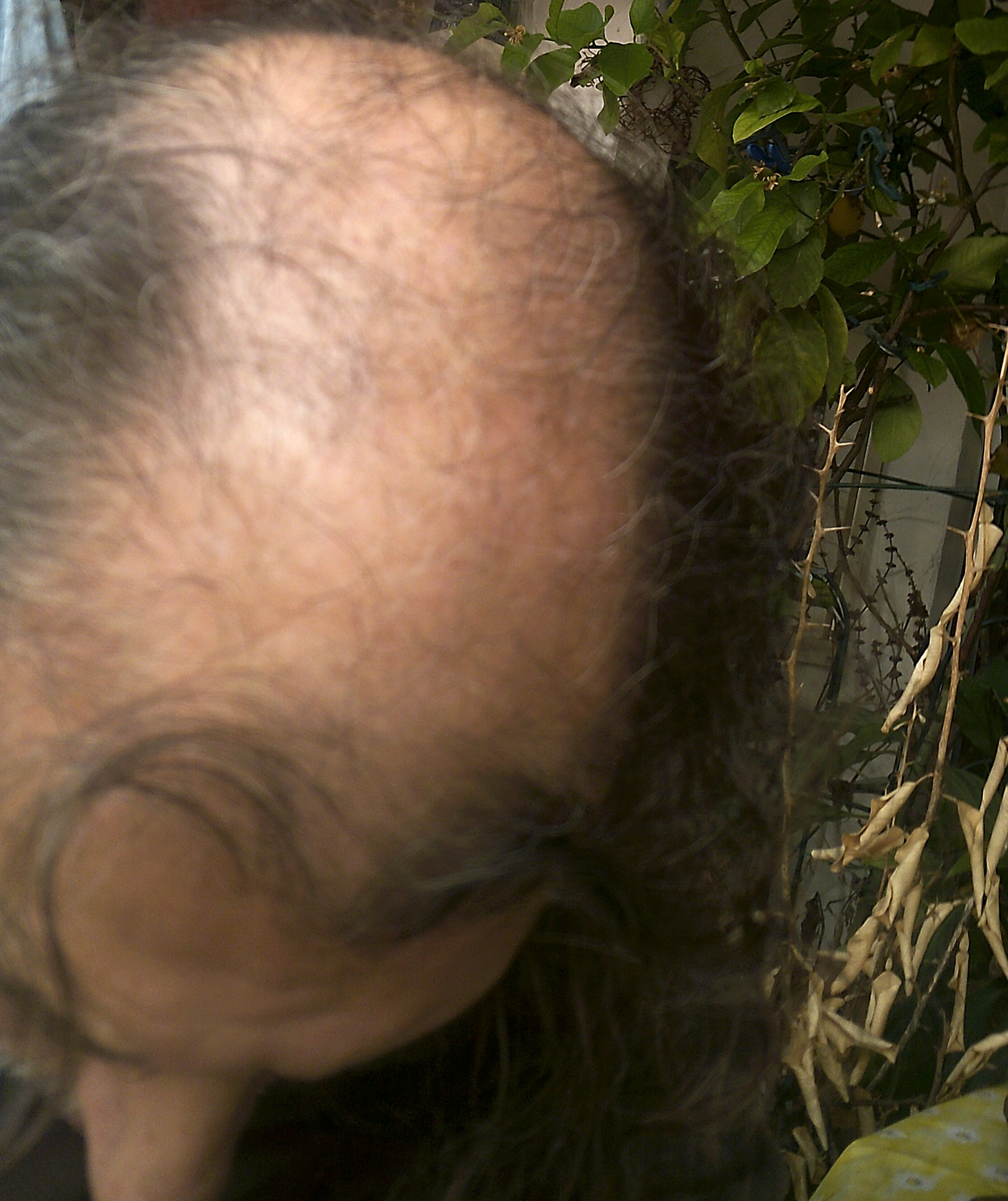 /foren/transplant/index.php/fa/62850/0/