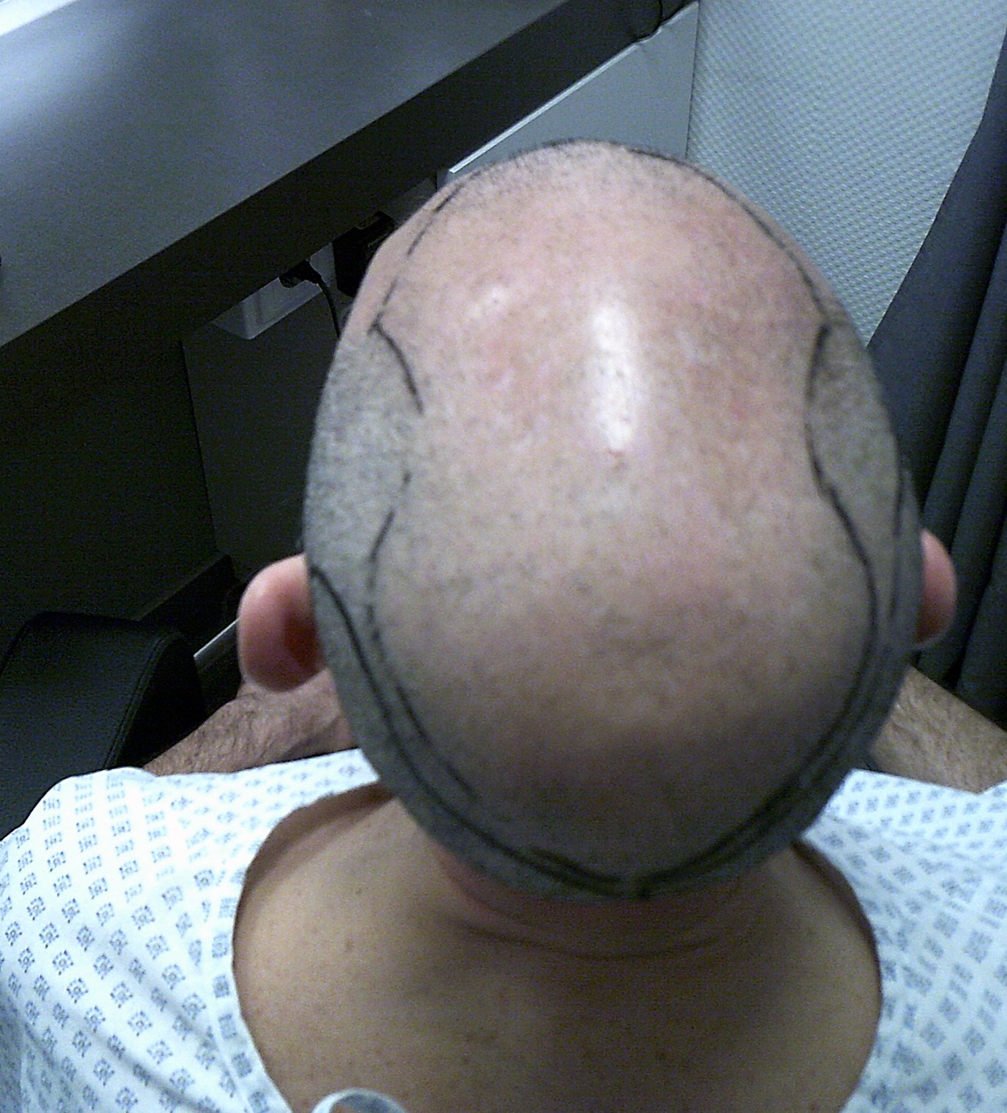 /foren/transplant/index.php/fa/62875/0/