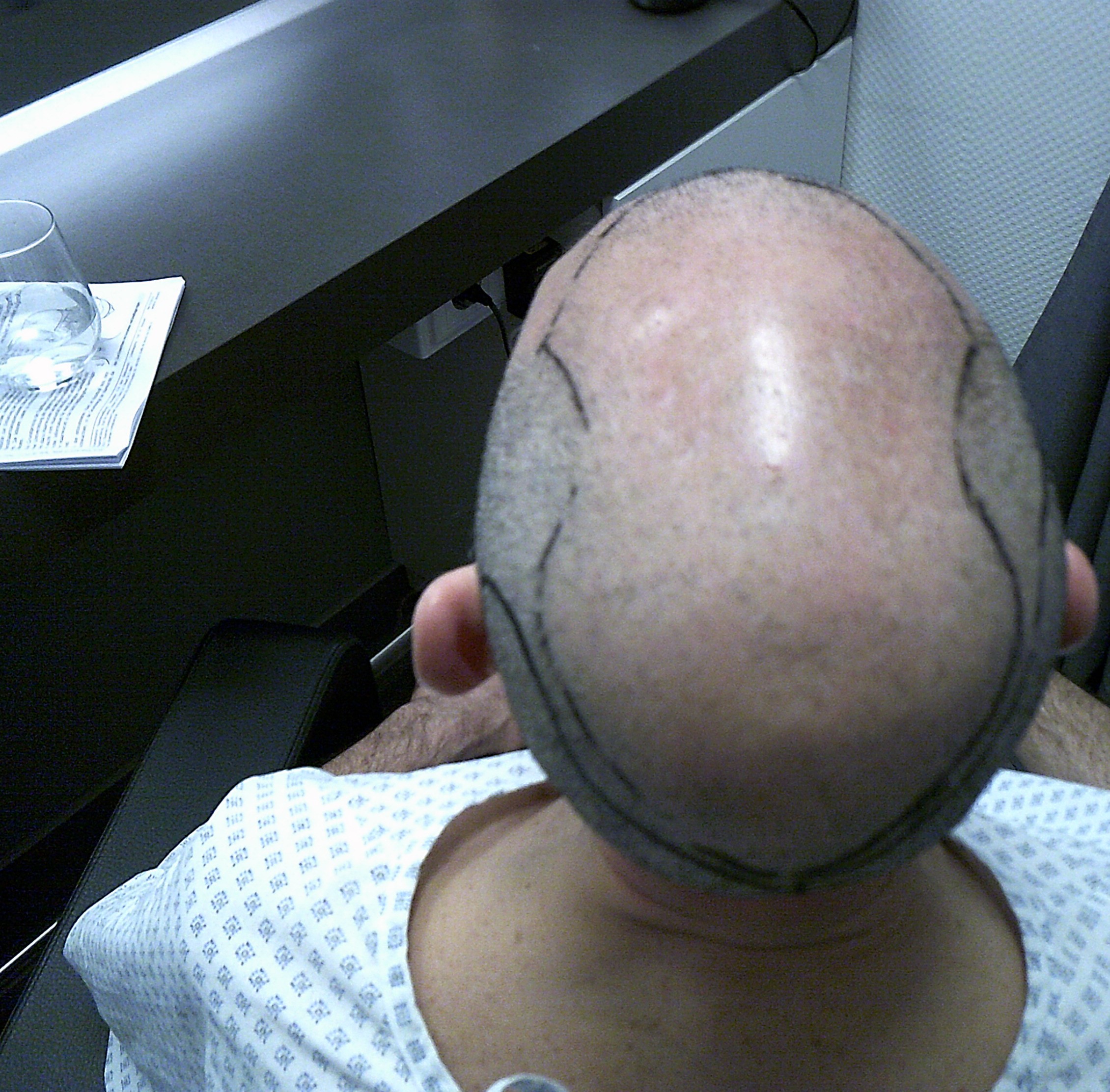 /foren/transplant/index.php/fa/62883/0/