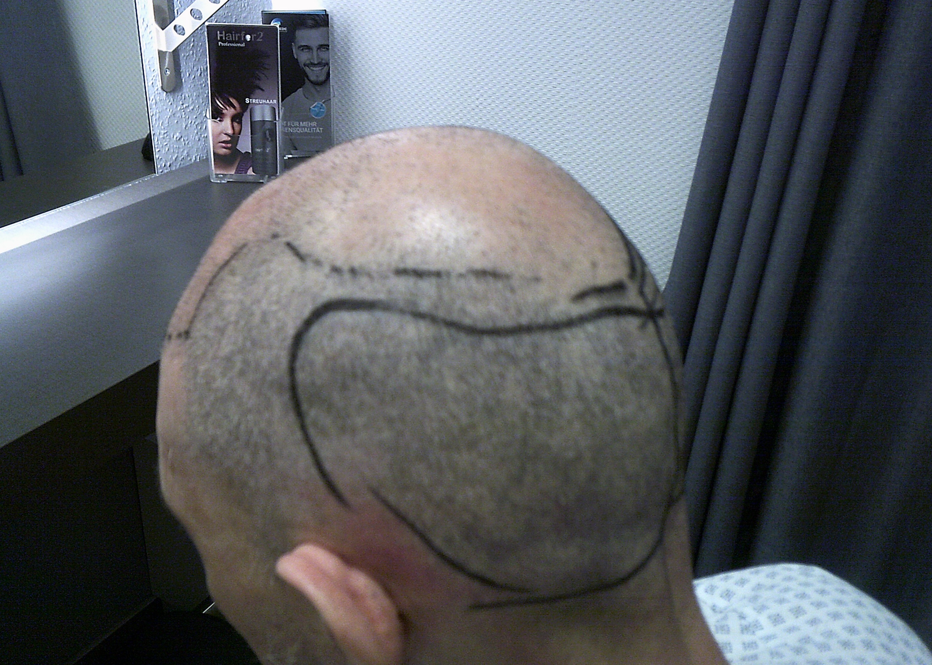 /foren/transplant/index.php/fa/62884/0/